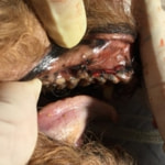 加藤波留フラップ縫合